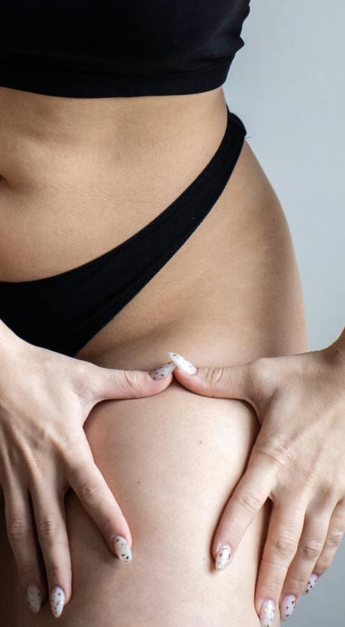 HR Plastic Sugery Loose excess thigh - leg skin